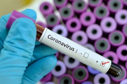 f552395c60b1b757b1b9197a4222c8fe preview w440 h290 - ​За добу у Житомирській області підтвердили 827 нових випадків коронавірусу, 15 пацієнтів померли